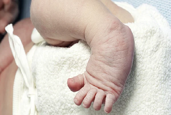 Pediatric Deformities And Trauma